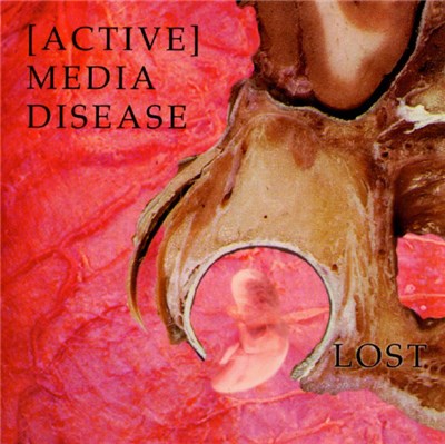 [Active] Media Disease - Lost download mp3 flac