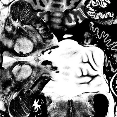 Regosphere / The Vomit Arsonist - Regosphere / The Vomit Arsonist Split download mp3 flac