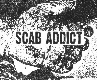 Scab Addict / Castration Rite - Scab Addict/Castration Rite download mp3 flac