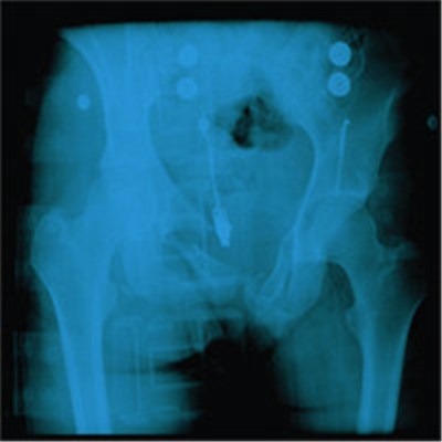 Mature Situations - Cracked Pelvis download mp3 flac