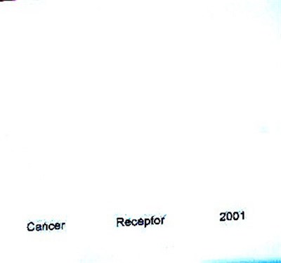 Cáncer - Receptor download mp3 flac