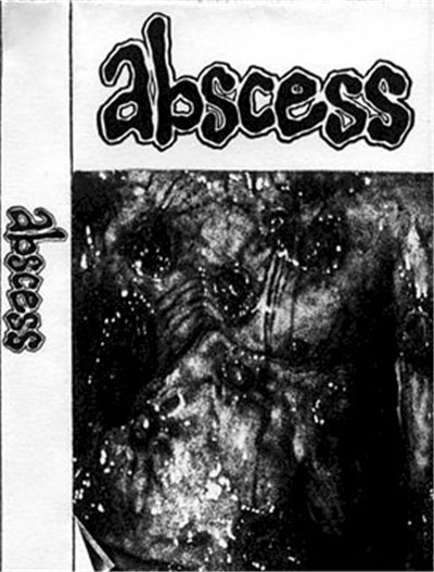 Abscess - Abscess download mp3 flac