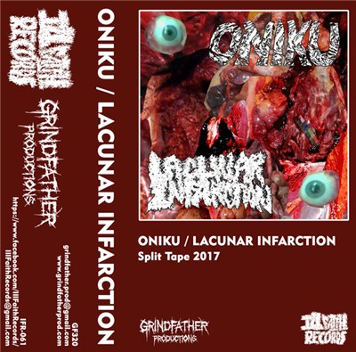 Oniku / Lacunar Infarction - Oniku / Lacunar Infarction download mp3 flac