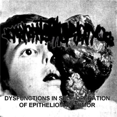 Vomithanatophorichthyosis - Dysfunctions in Self Operation of Epithelioman Tumor download mp3 flac