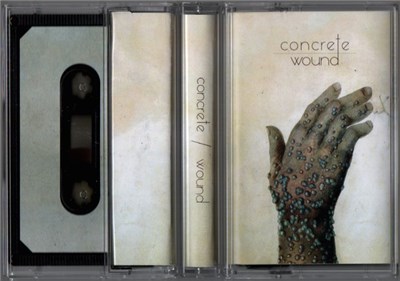 Concrete/Field & Wound - Concrete / Wound download mp3 flac