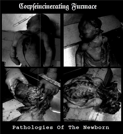Corpseincinerating Furmace - Pathologies Of The Newborn download mp3 flac