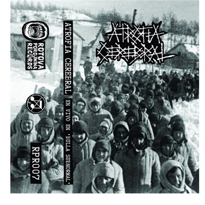 Atrofia Cerebral - Bulla Subnormal download mp3 flac