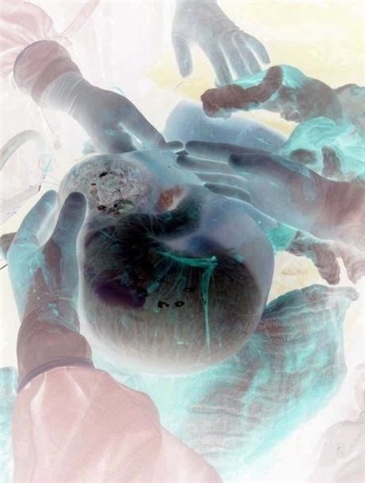 Foul - Afterbirth download mp3 flac