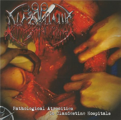 Dicephalus - Pathological Atrocities In Clandestine Hospitals download mp3 flac