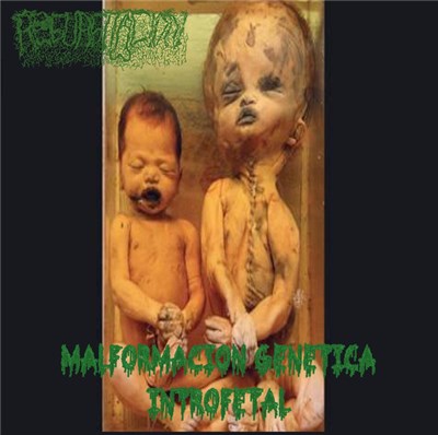Regurgitacion - Malformación Genética Introfetal download mp3 flac