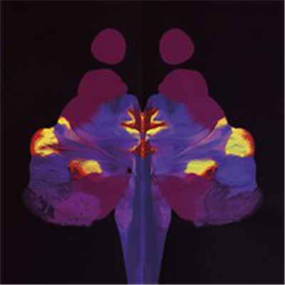 Loiriplukari - Näyttää Spedeltä, Kuulostaa Veskulta Ja Pidättää Hengitystä Ihan Simona download mp3 flac