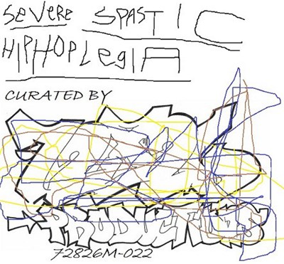 Various - Severe Spastic Hiphoplegia download mp3 flac
