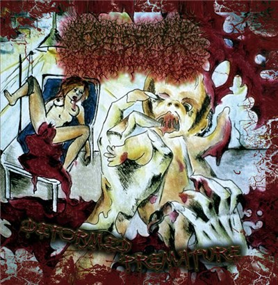 Paediatrician - Deformed Premature download mp3 flac
