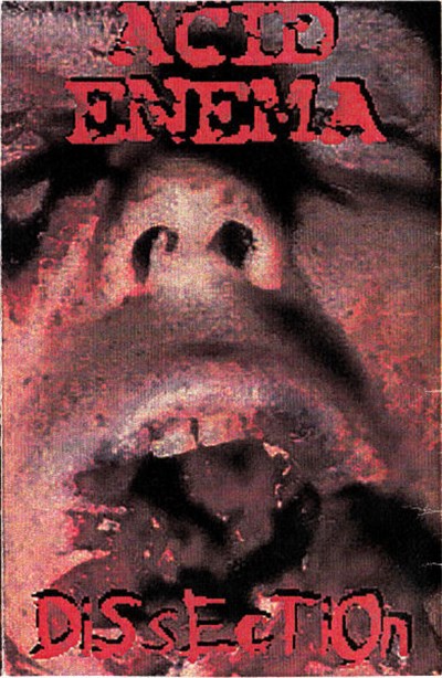 Acid Enema - Dissection download mp3 flac
