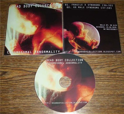 Dead Body Collection - Chromosomal Abnormality download mp3 flac