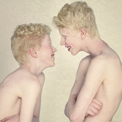 Albinos Agony - The Other Hit download mp3 flac