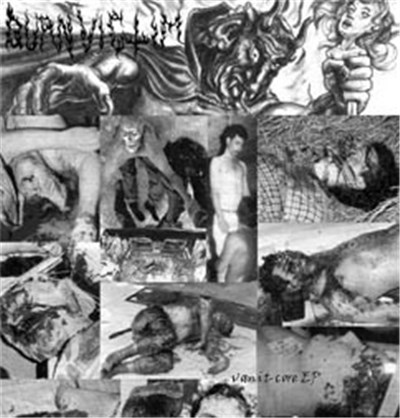 Burn Victim - Vomit-core EP download mp3 flac