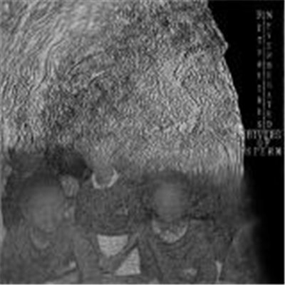 Neverberated / Retrovirus - Rivers Of Sperm download mp3 flac