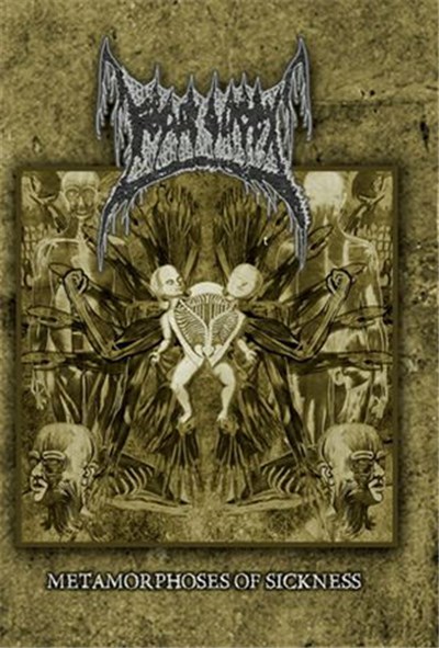 Fetus Slicer - Metamorphoses of Sickness download mp3 flac
