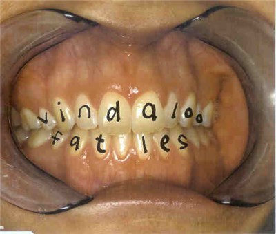 Fat Les - Vindaloo download mp3 flac